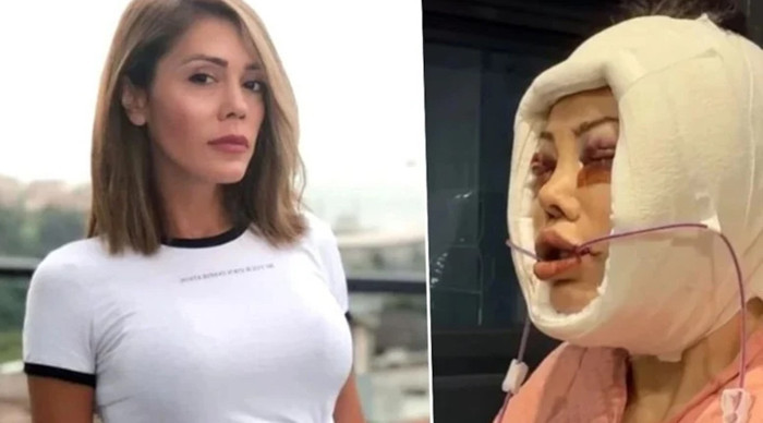 Kore'de yüz nakli olan fenomen son halini paylaştı: ''Bu yüz kaç yaşında?''