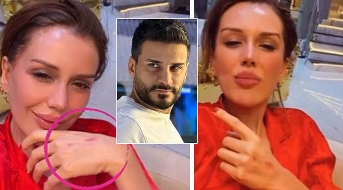 Elleri çizik içinde kalan Dilan Polat sosyal medya hesabını kapattı