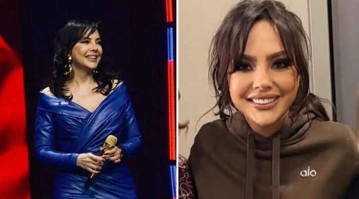 Ebru Gündeş’in 200 bin dolara estetik yaptırdığı iddiası ortalığı karıştırdı