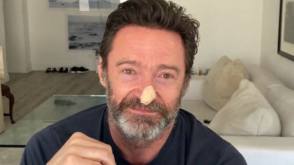 Hugh Jackman sağlık durumuyla ilgili gerçeği açıkladı!