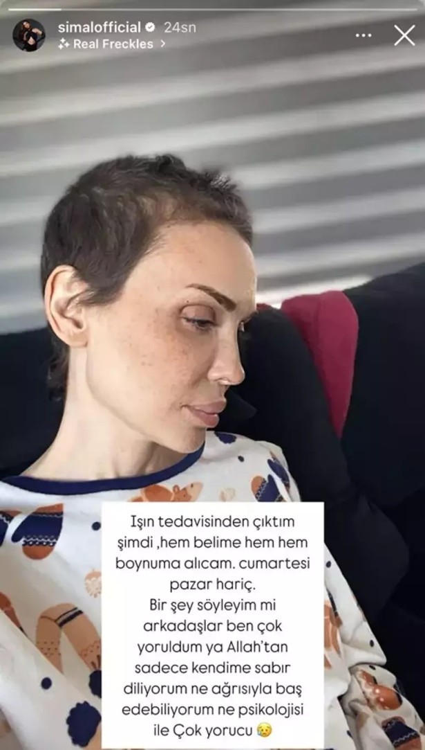 Işın tedavisinden çıkan Şimal'den ilk açıklama: "Çok yoruldum"