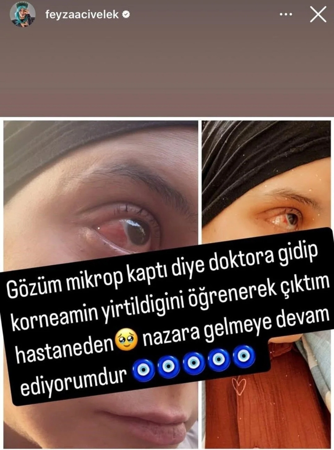 Talihsizlikler Feyza Civelek'in peşini bırakmıyor - Resim : 2