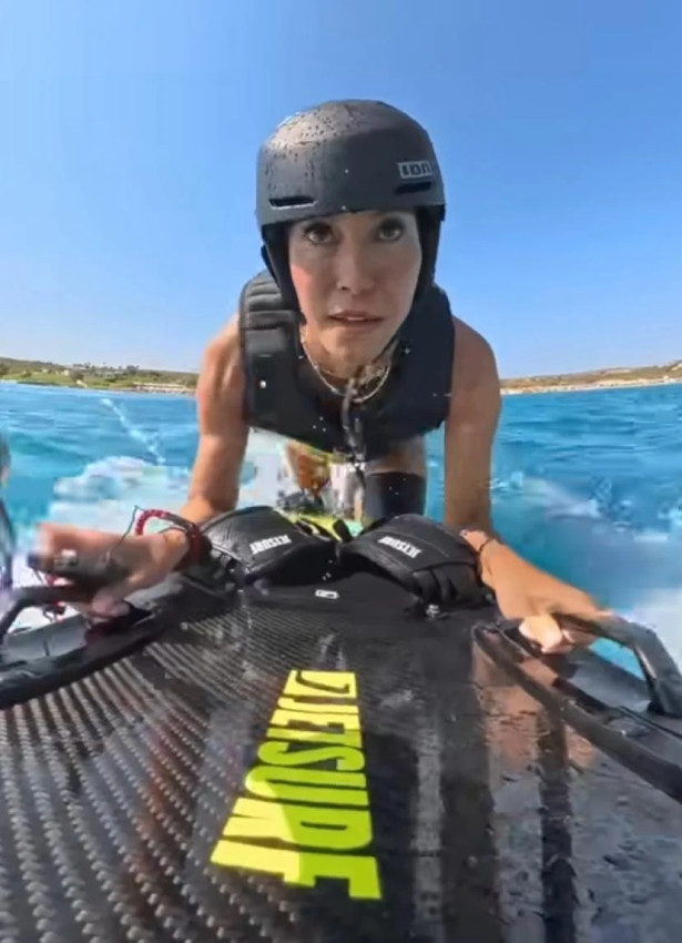 Çağla Şıkel'in bacakları mosmor oldu - Resim : 2