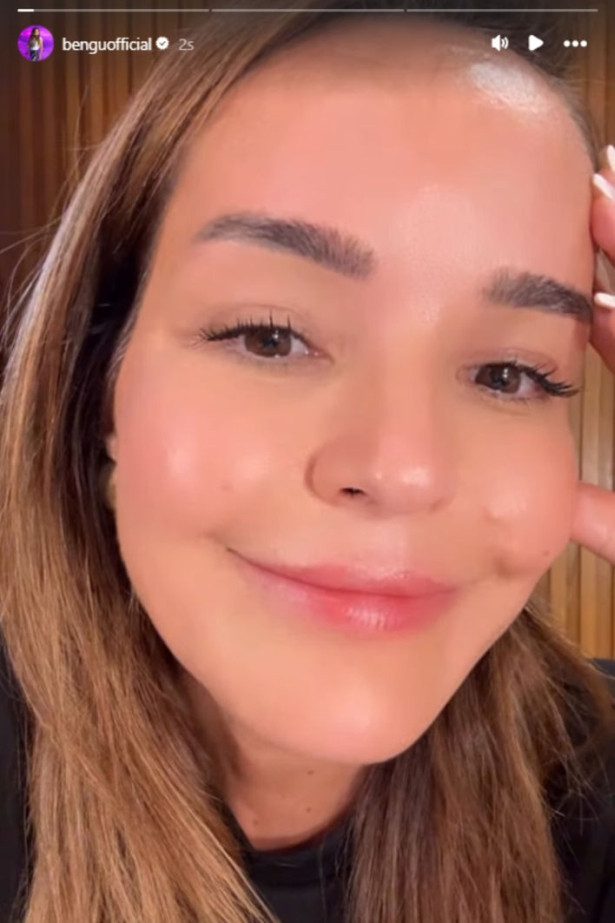 Bengü'nün yüzündeki değişim şaşırttı