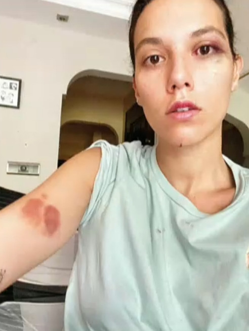 Ozan Güven hakkında bomba aşk iddiası! - Resim : 2