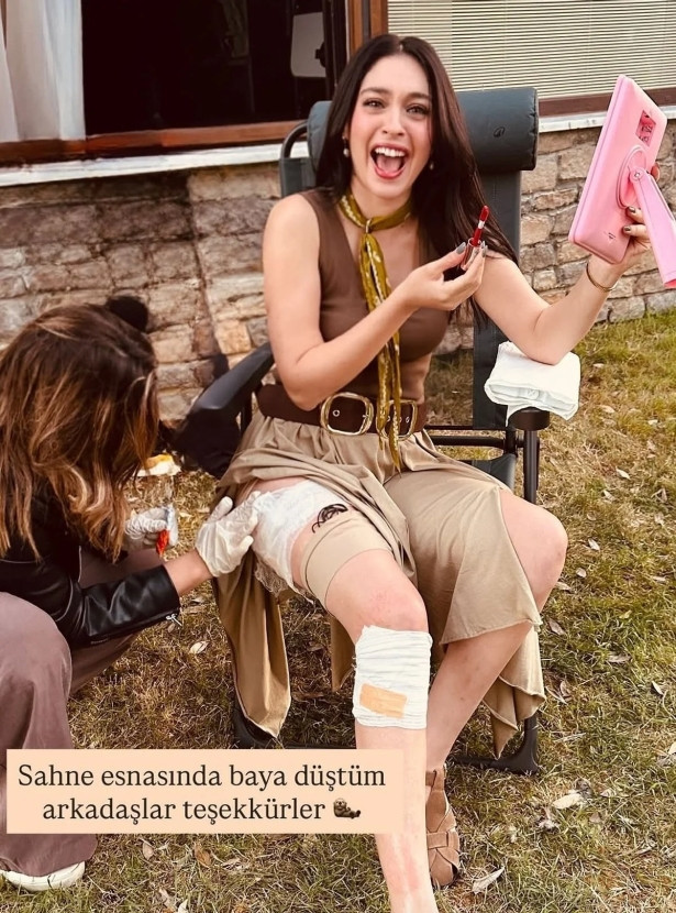 Sette kaza geçiren Cemre Baysel bacağından yaralandı