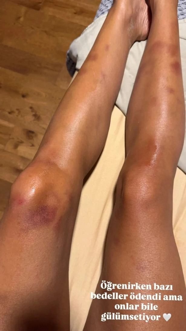 Çağla Şıkel'i İstanbul Boğazı'nda görenler şaşırdı - Resim : 2