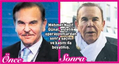 Mehmet Nazif Günal bir dizi estetik operasyon geçirdi! - SacitAslan.com